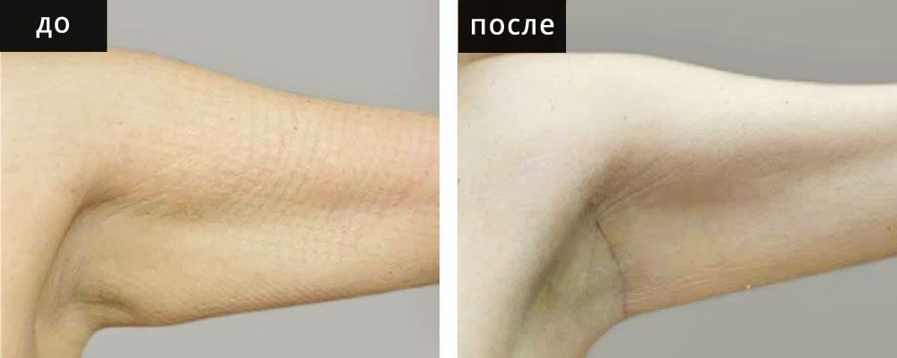 Брахиопластика: до и после – фото 6