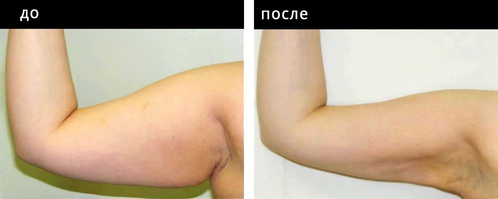 Брахиопластика: до и после – фото 4