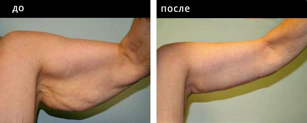Брахиопластика: до и после – фото 3