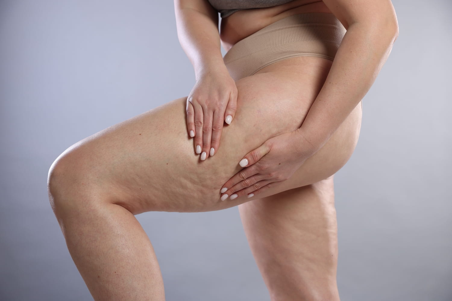 Как избавиться от целлюлита на ногах и ягодицах Как избавиться от целлюлита на ногах и ягодицах