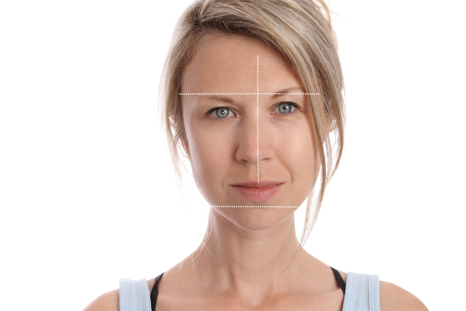 Асимметрия глаз Асимметрия глаз