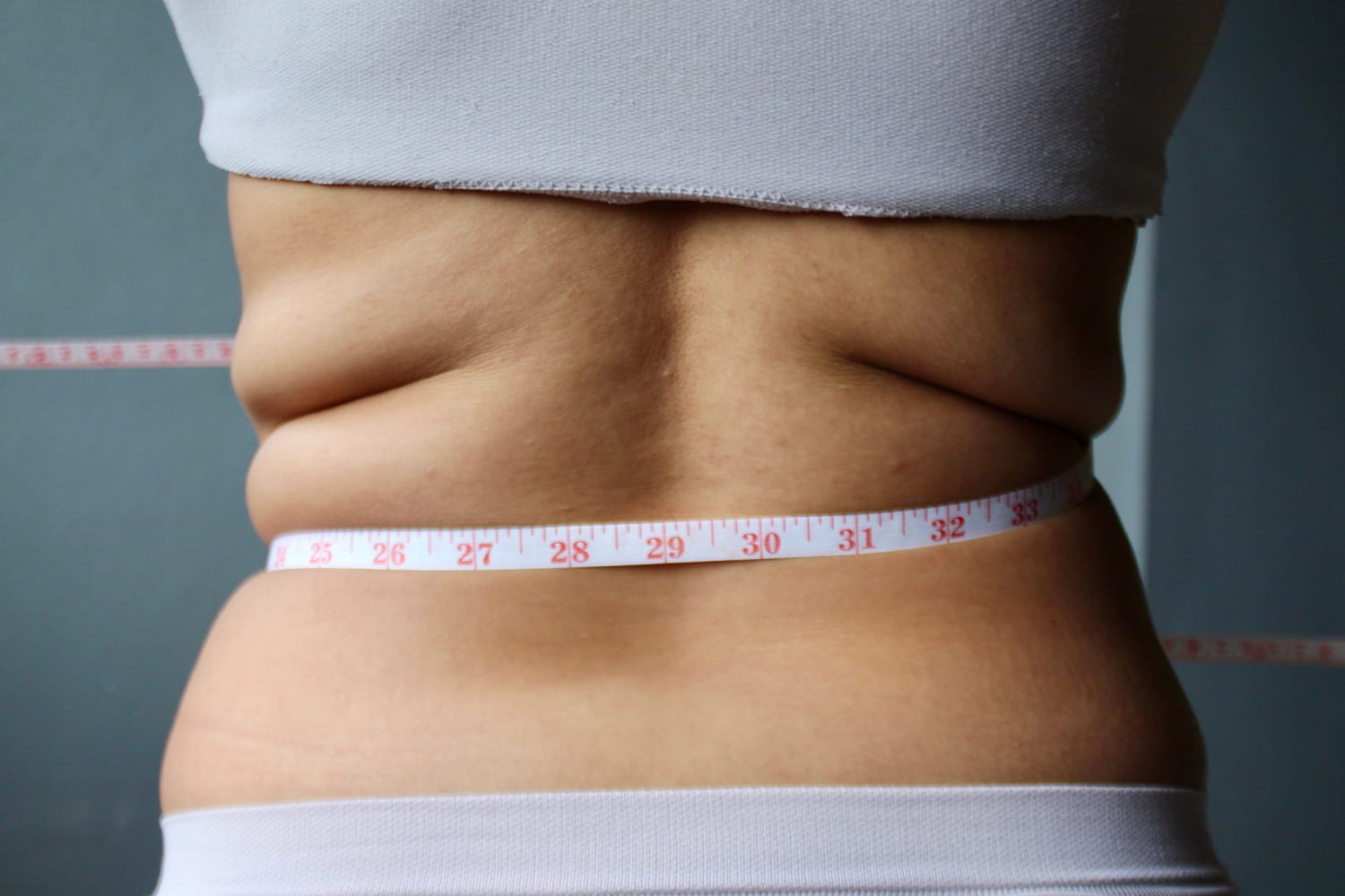 Сужение талии без удаления ребер