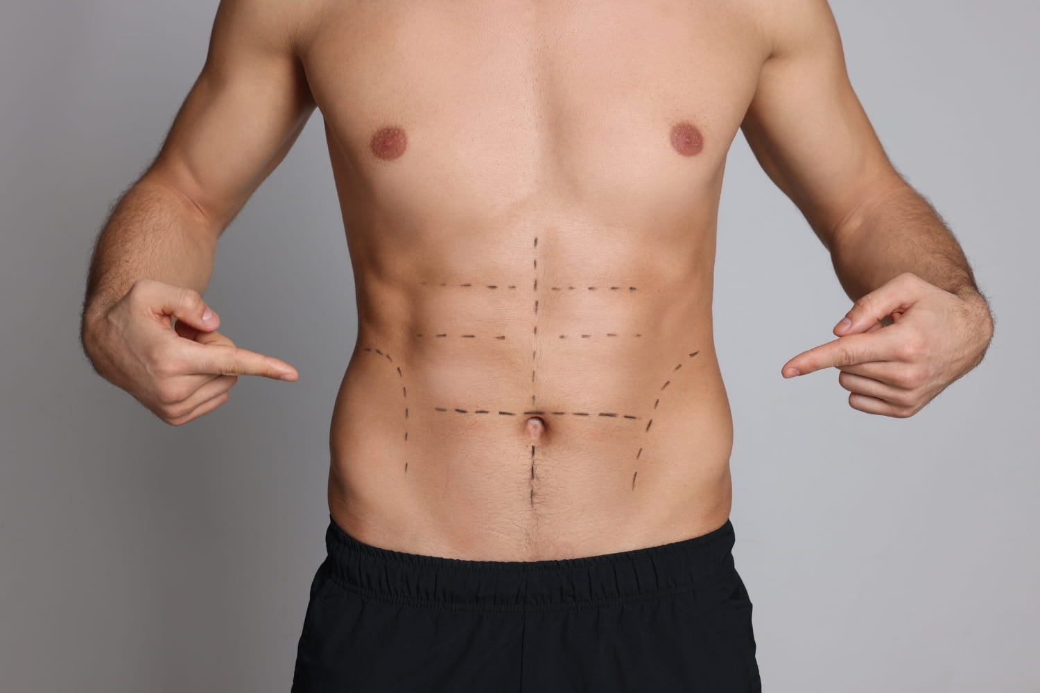 Результат профессиональной пластики тела для мужчин Результат профессиональной пластики тела для мужчин