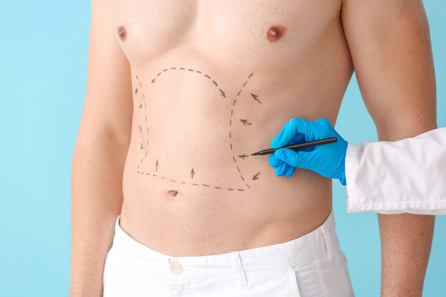 Пластика тела для мужчин Пластика тела для мужчин