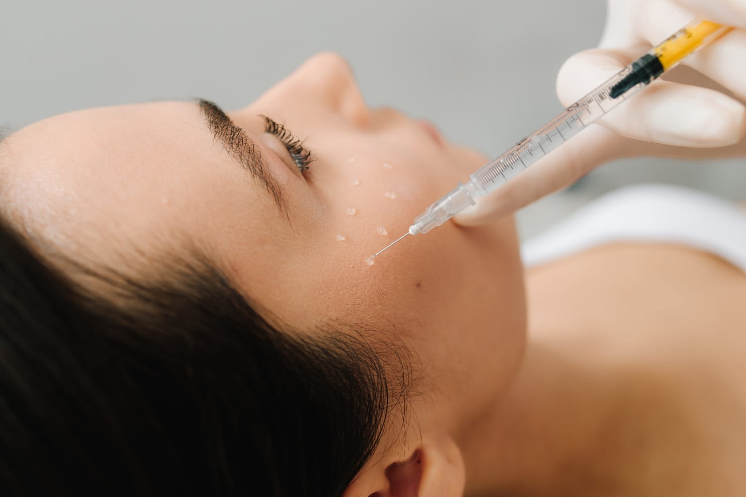 Филорга биоревитализация Филорга биоревитализация