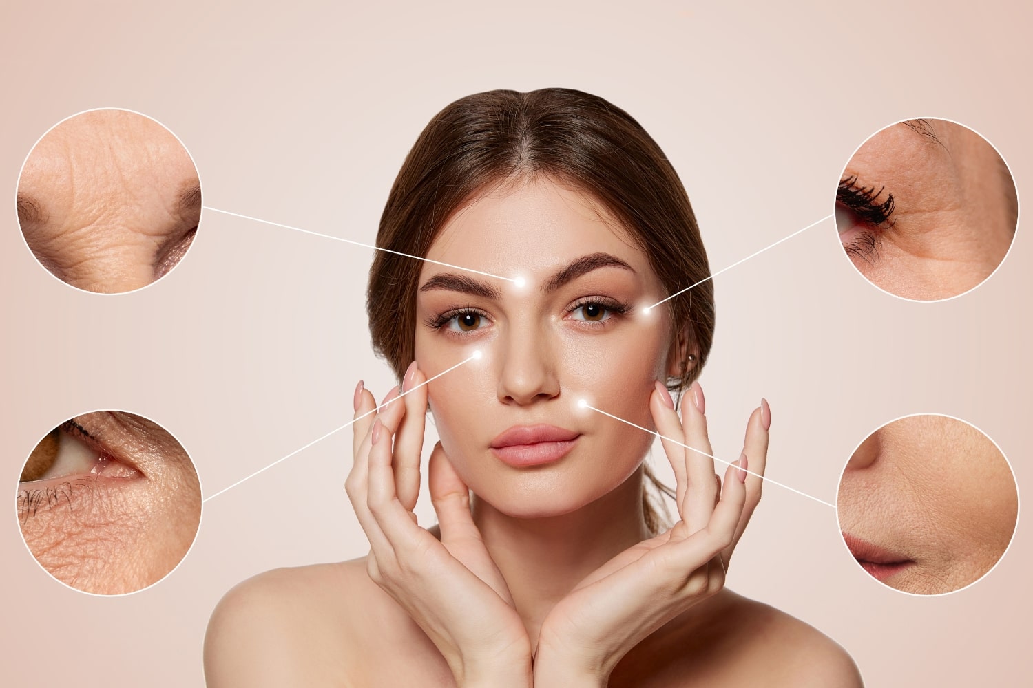 Ботулинотерапия релатокс