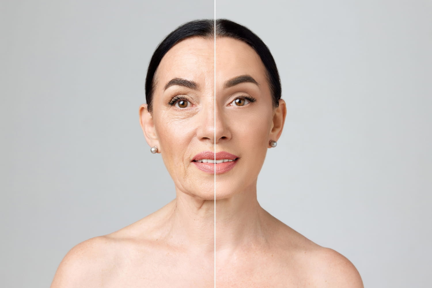 Этапы реабилитации после подтяжки лица по срокам Этапы реабилитации после подтяжки лица по срокам