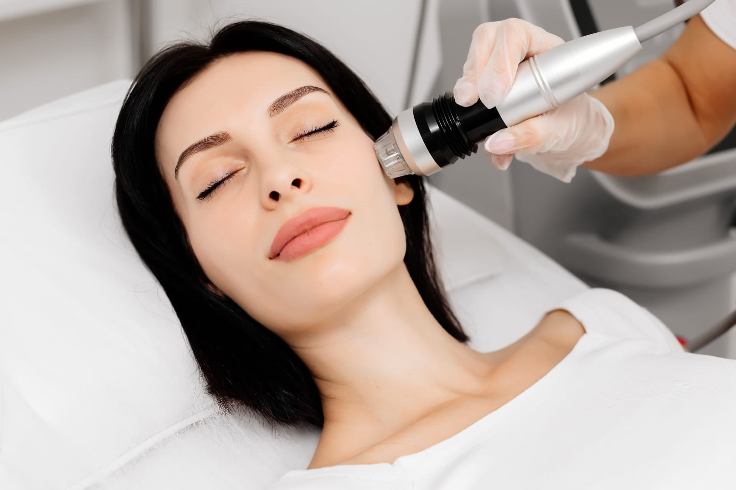 Омоложение и шлифовка фракционным лазером CO2 FONS SVR