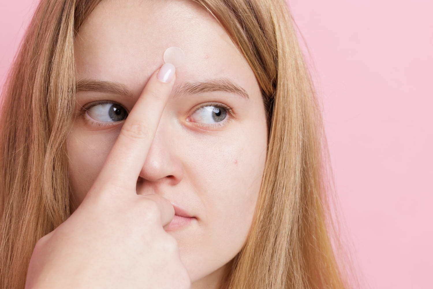 Когда шелушение и покраснение кожи на лбу – повод обратиться к дерматологу Когда шелушение и покраснение кожи на лбу – повод обратиться к дерматологу