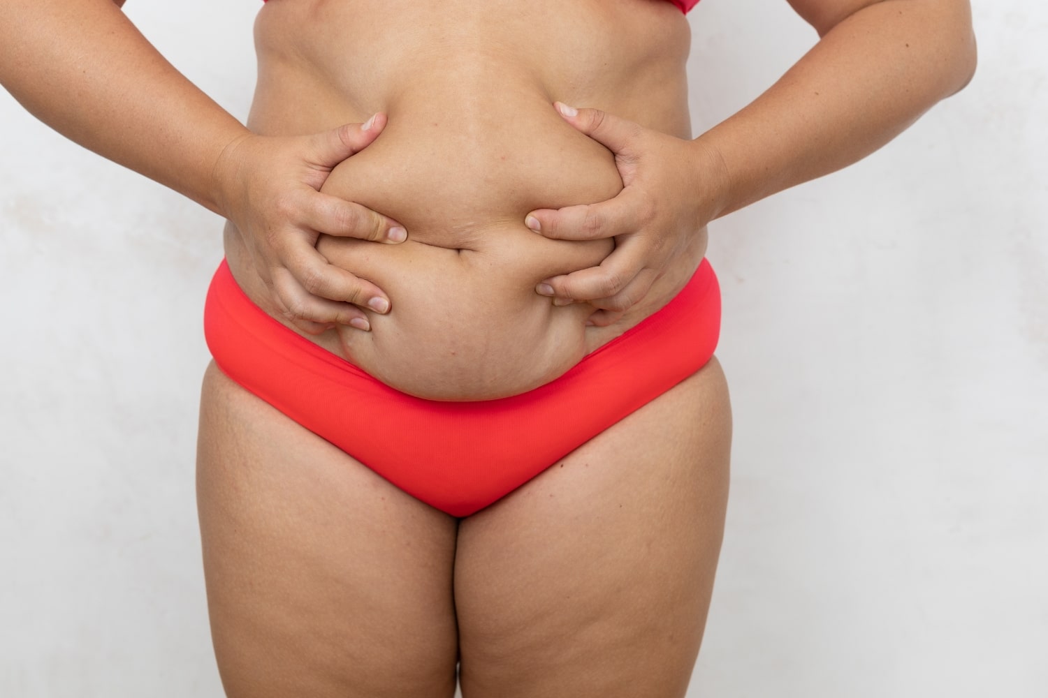 Липосакция и абдоминопластика