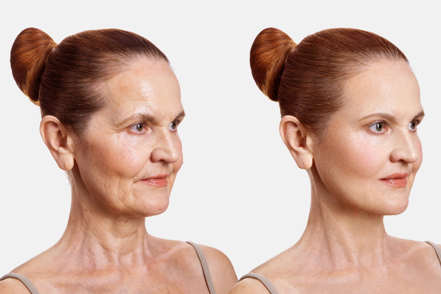 Программа комплексной реабилитации после подтяжки лица в ОН КЛИНИК Программа комплексной реабилитации после подтяжки лица в ОН КЛИНИК