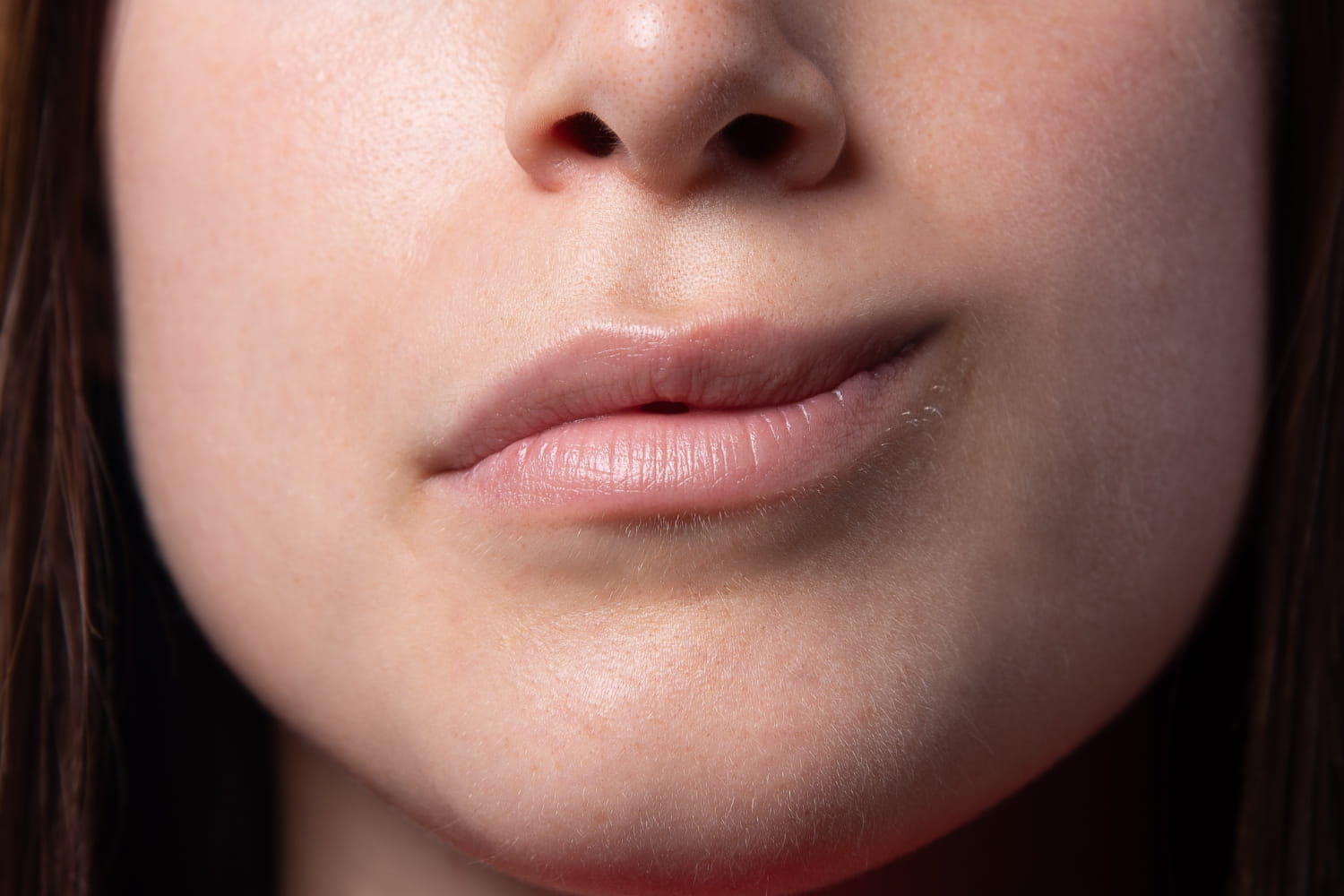 Асимметрия губ