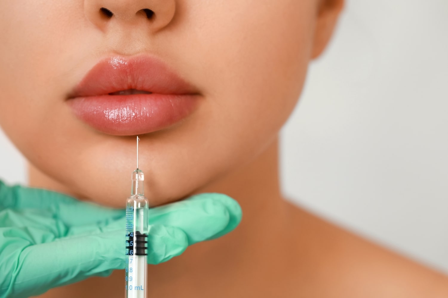 Контурная пластика Juvederm