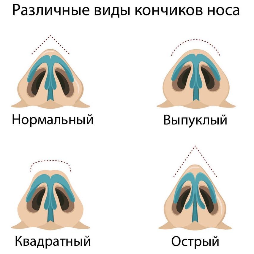 Различные виды кончиков носа