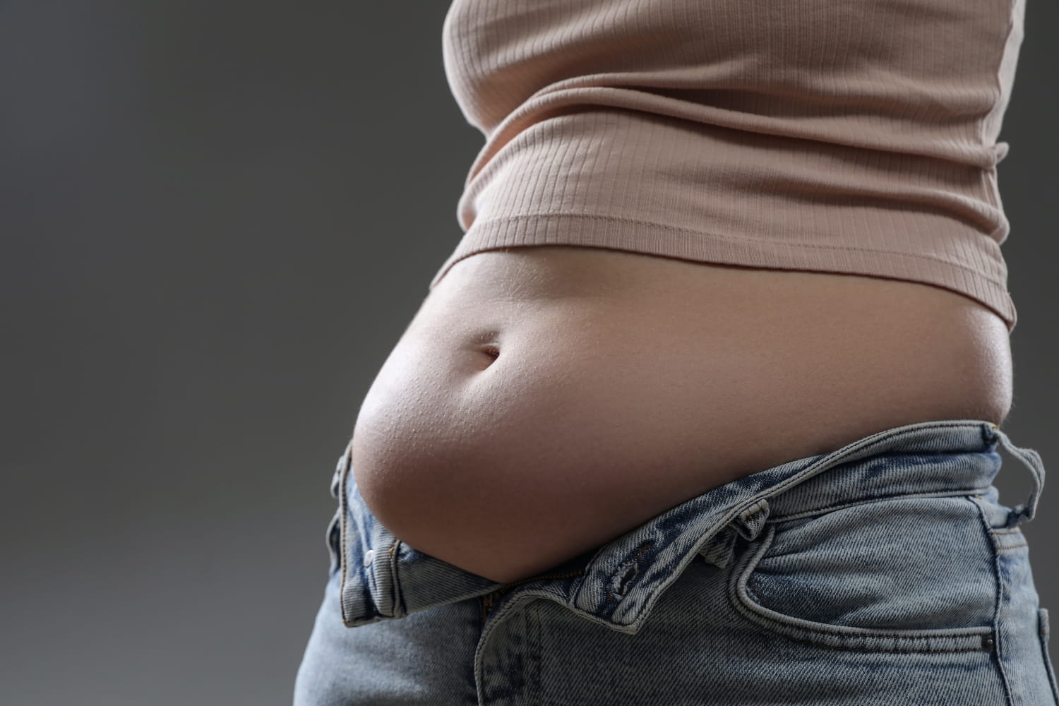 Пластика диастаза прямых мышц