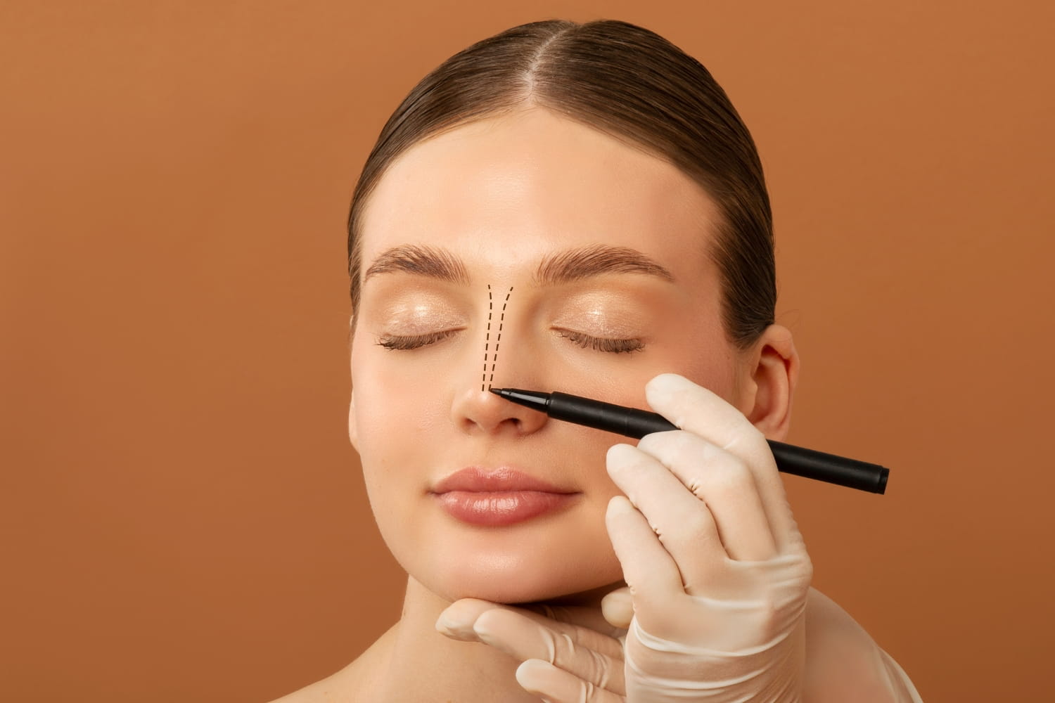 Ринопластика в Центре пластической хирургии ОН КЛИНИК Ринопластика в Центре пластической хирургии ОН КЛИНИК