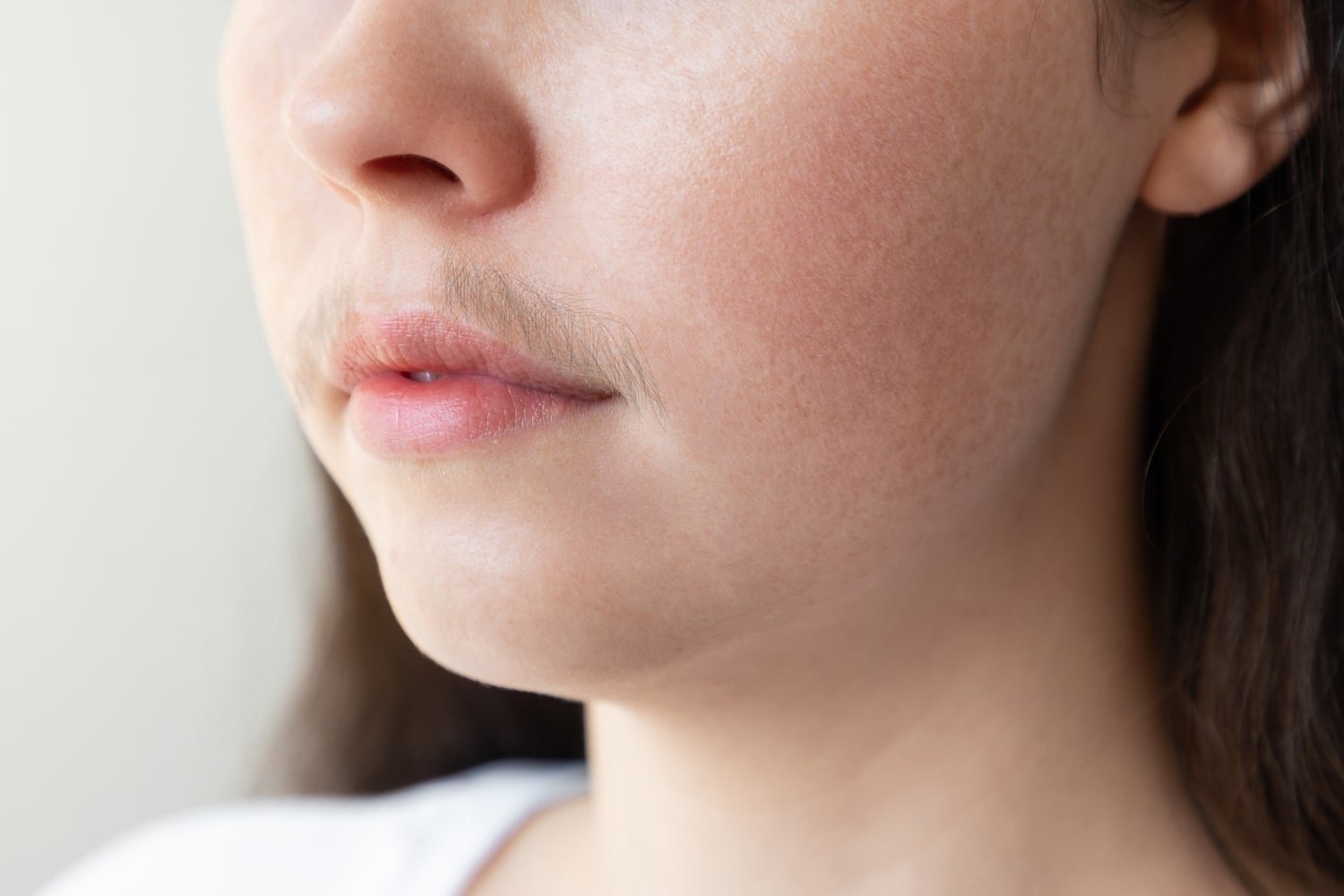 Гирсутизм: причины и факторы риска