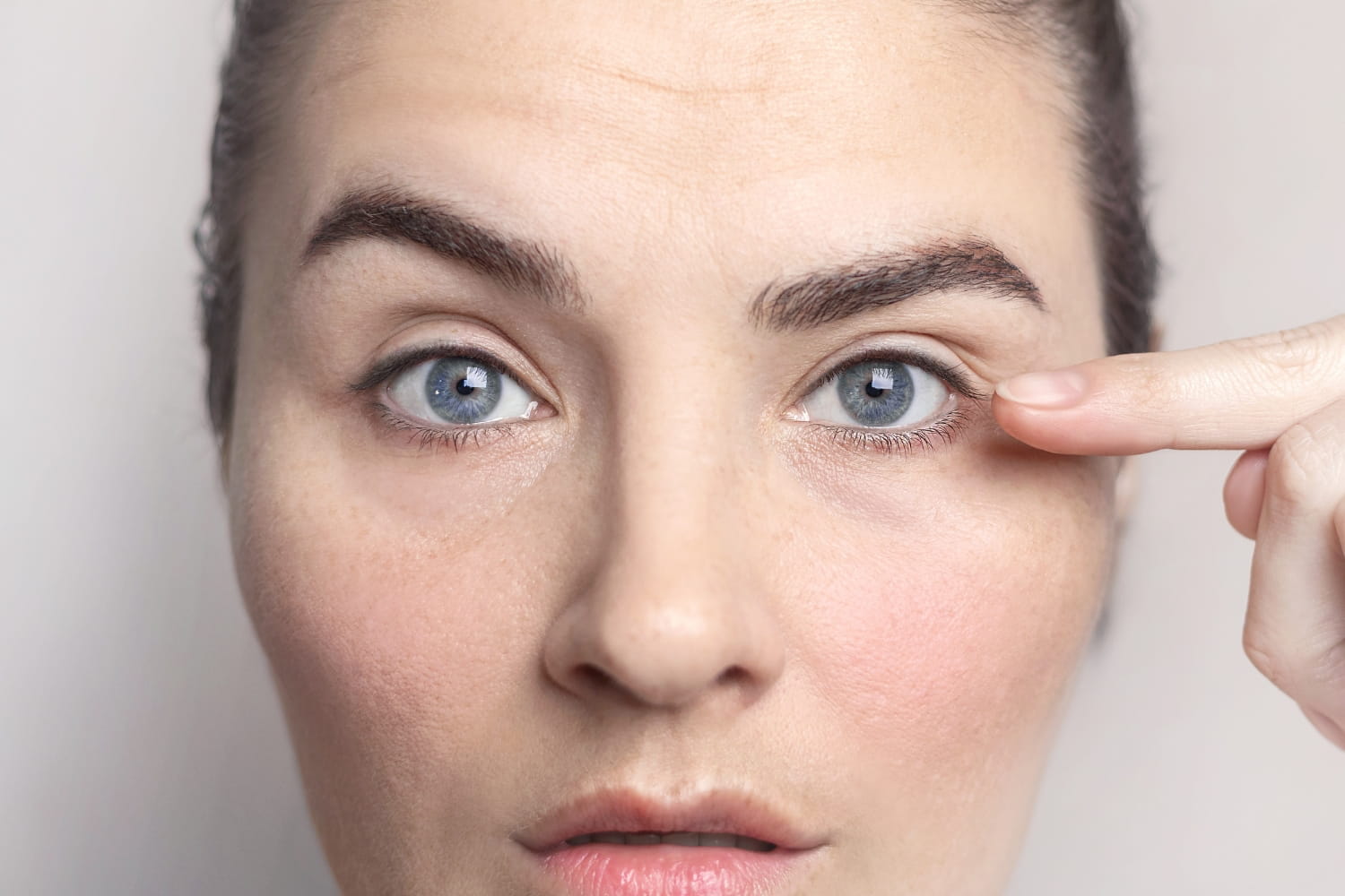 Причины асимметрии глаз Причины асимметрии глаз