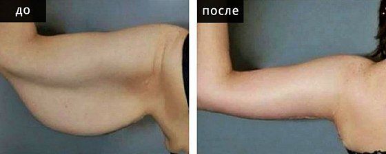 Брахиопластика. Гусляков 02: до и после – фото 2