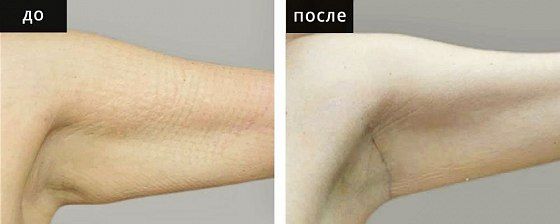 Брахиопластика. Гусляков 06: до и после – фото 6