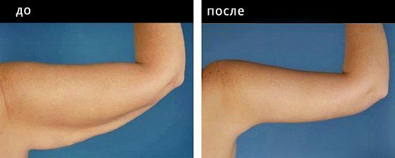 Брахиопластика. Гусляков 05: до и после – фото 5