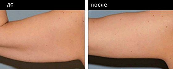 Брахиопластика. Гусляков 01: до и после – фото 1