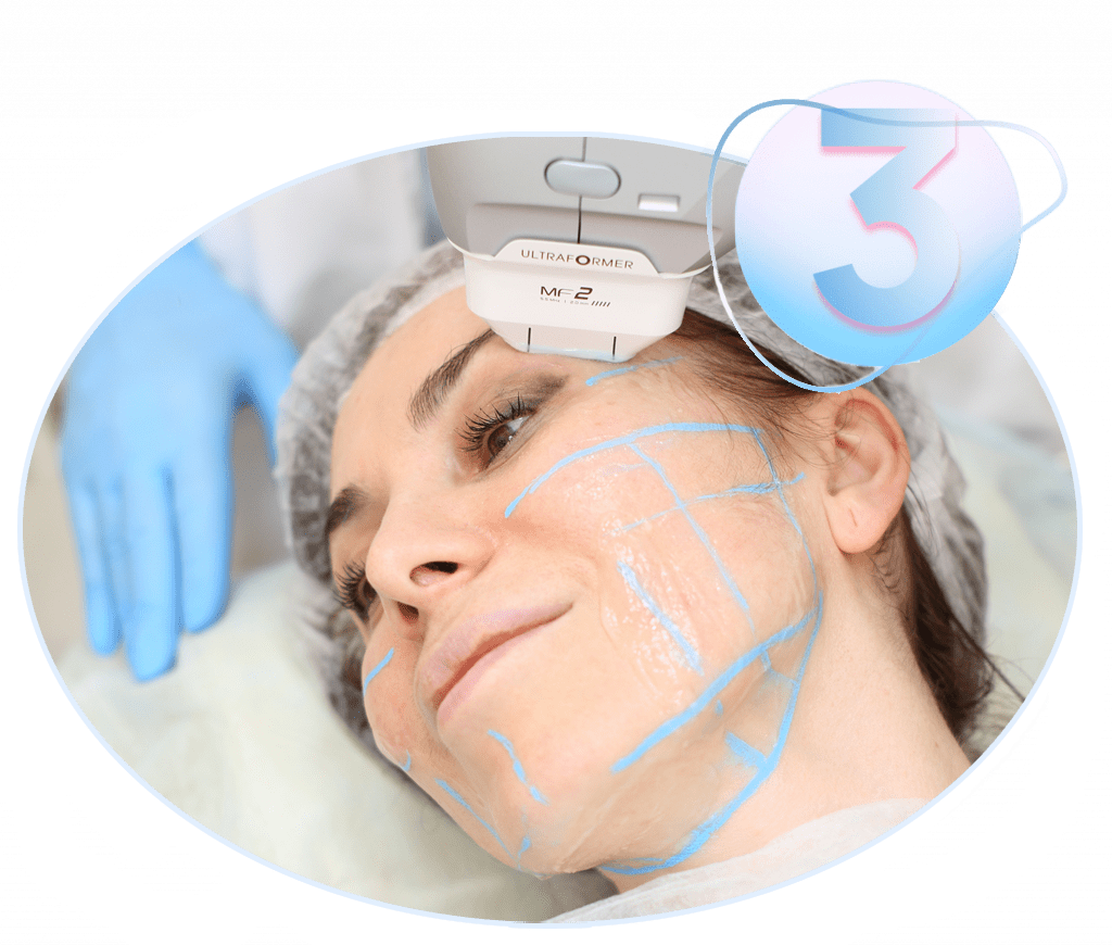 <p>Косметолог с помощью насадки точечно воздействует на кожу. На каждом участке врач останавливается на пару секунд — этого достаточно, чтобы УФ-луч проник в глубокие слои дермы и запустил процесс ремоделирования тканей. Пациент не испытывает боли и дискомфорта — это одно из главных преимуществ аппарата Ultraformer III.</p>